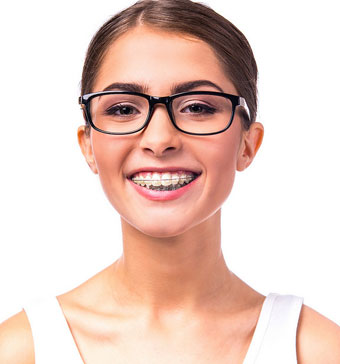 radiance brackets